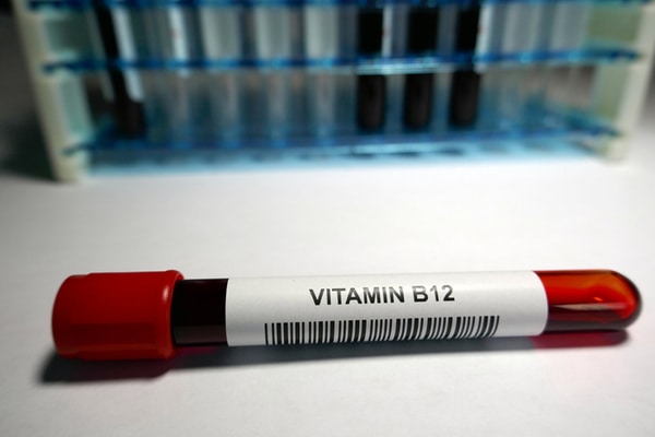 How a Vitamin B12 Test Is Done
